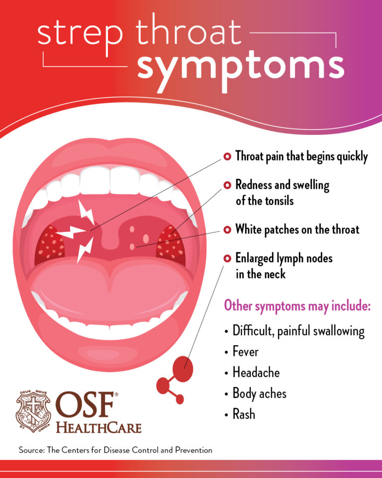 What To Know About Strep Throat OSF HealthCare