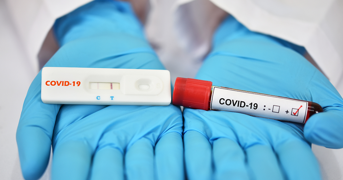 COVID-19: Simple glucose meter test could tell if you have antibodies