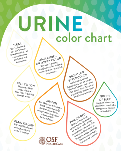 What color should your urine be? | OSF HealthCare