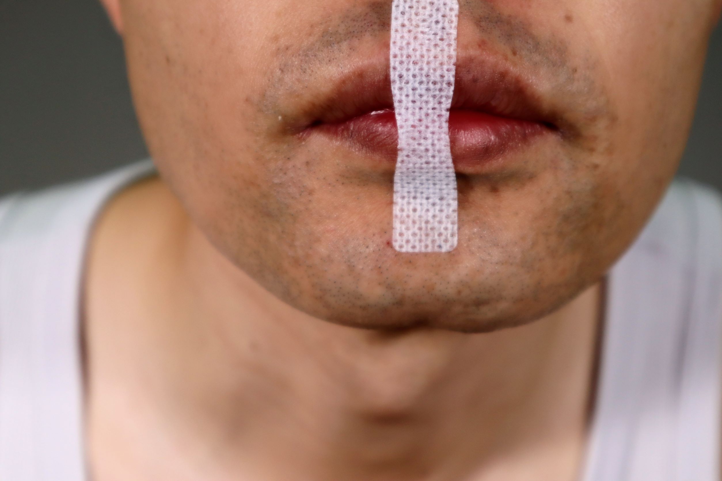 Mouth Taping for Sleep, Oral Health: Doctors Warn of Risks