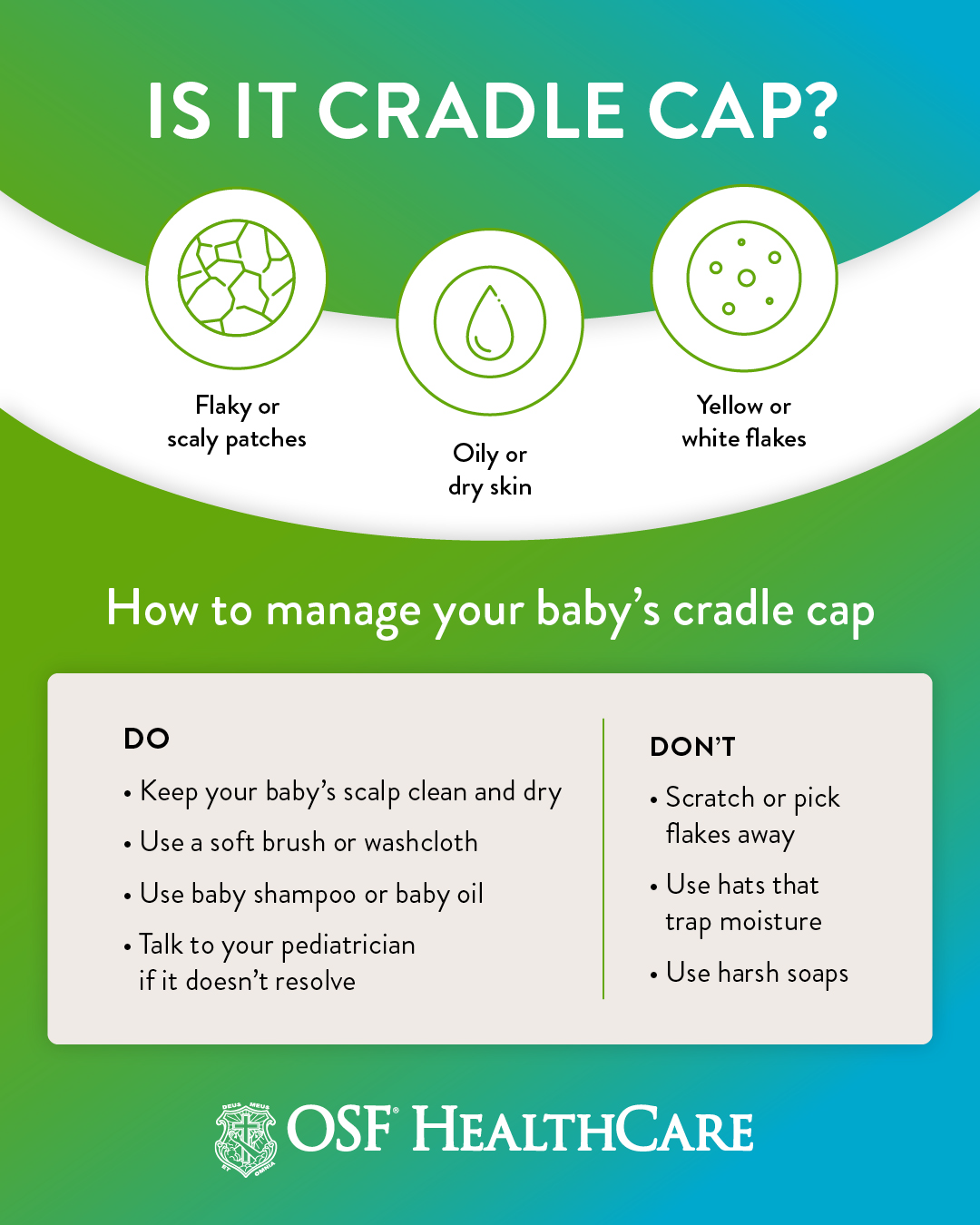 What Is Cradle Cap And How Is It Treated Osf Healthcare 7853