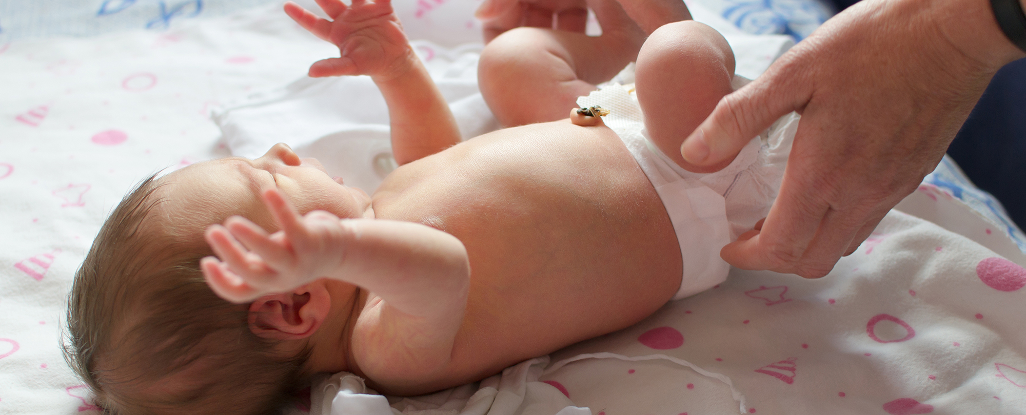 How to care for your baby's umbilical cord